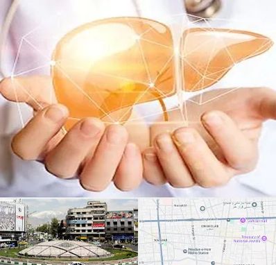 دکتر سرطان کبد در مرکز تهران