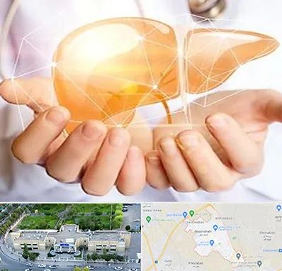 دکتر سرطان کبد در نسیم شهر