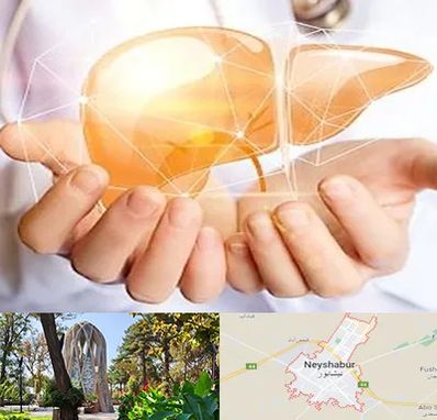 دکتر سرطان کبد در نیشابور