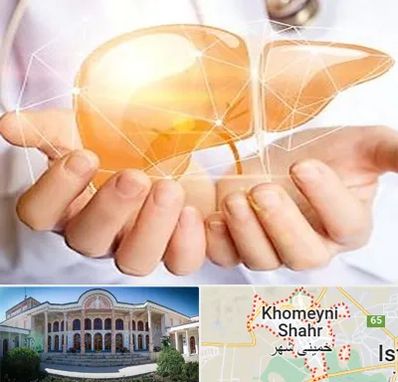 دکتر سرطان کبد در خمینی شهر