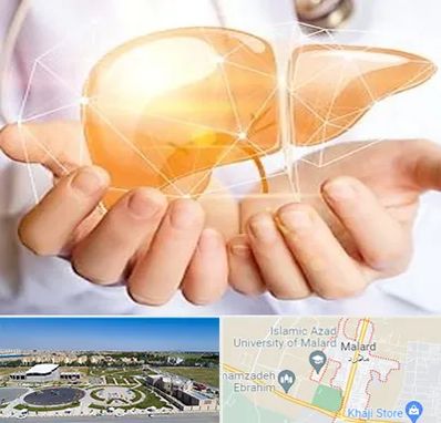 دکتر سرطان کبد در ملارد