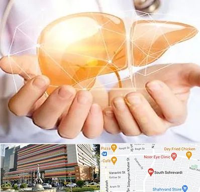 دکتر سرطان کبد در سهروردی 