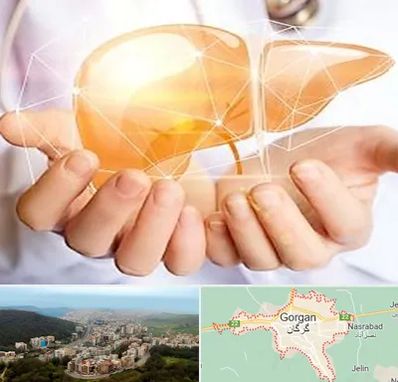 دکتر سرطان کبد در گرگان
