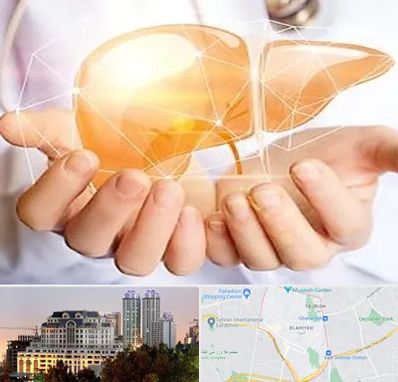 دکتر سرطان کبد در فرشته 