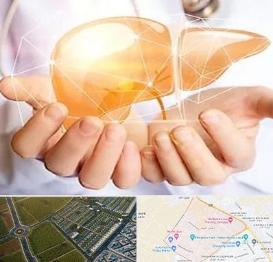 دکتر سرطان کبد در الهیه مشهد 