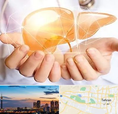 دکتر سرطان کبد در غرب تهران 