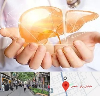 دکتر سرطان کبد در ولیعصر شهریار
