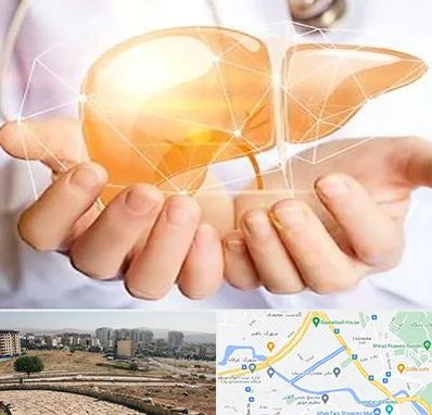 دکتر سرطان کبد در کوی وحدت شیراز 