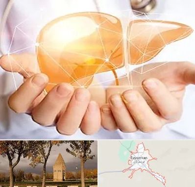 دکتر سرطان کبد در تویسرکان