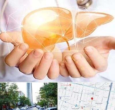 دکتر سرطان کبد در امامت مشهد 