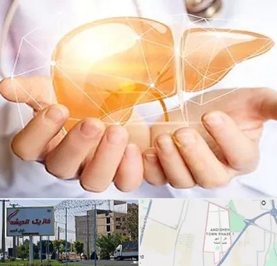 دکتر سرطان کبد در فاز یک اندیشه