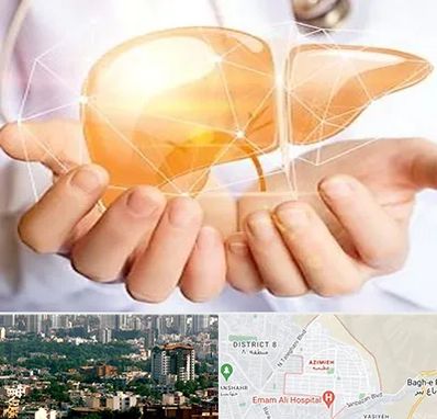 دکتر سرطان کبد در عظیمیه کرج 