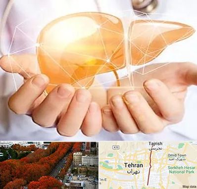 دکتر سرطان کبد در ولیعصر 