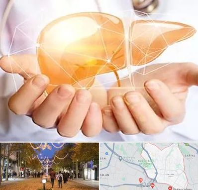 دکتر سرطان کبد در ولیعصر ارومیه