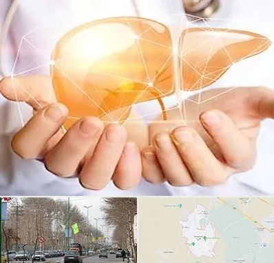 دکتر سرطان کبد در نظرآباد کرج 