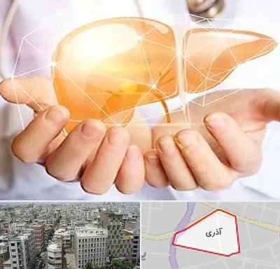 دکتر سرطان کبد در آذری