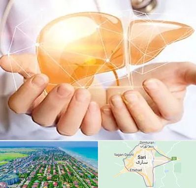 دکتر سرطان کبد در ساری