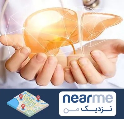 دکتر سرطان کبد در نزدیک من