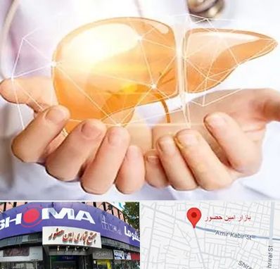 دکتر سرطان کبد در امین حضور