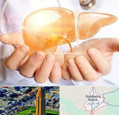 دکتر سرطان کبد در گنبد کاووس
