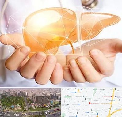 دکتر سرطان کبد در آیت الله کاشانی