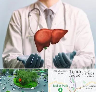 جراح سرطان کبد در تجریش 