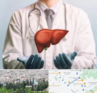 جراح سرطان کبد در محلاتی شیراز 