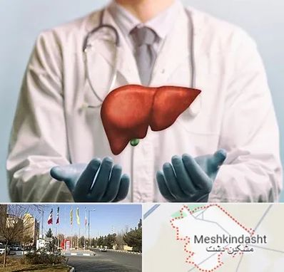 جراح سرطان کبد در مشکین دشت