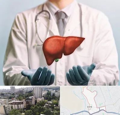 جراح سرطان کبد در اوین