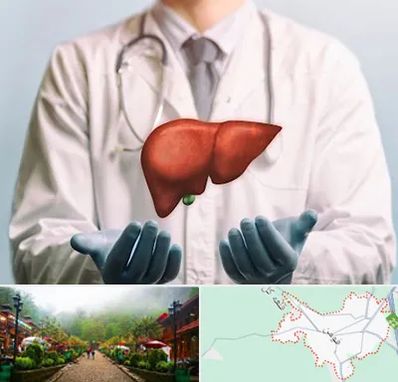 جراح سرطان کبد در فومن