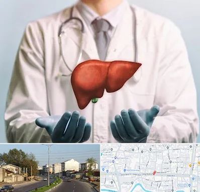 جراح سرطان کبد در ضیابری رشت 