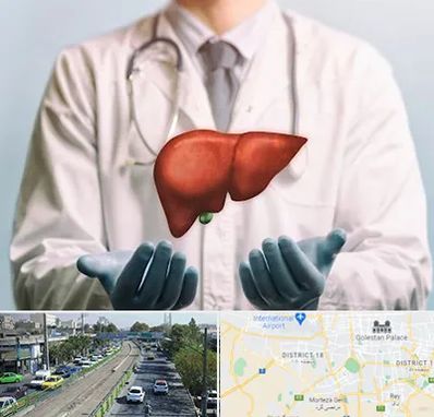 جراح سرطان کبد در جنوب تهران 