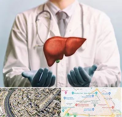 جراح سرطان کبد در شهرک غرب مشهد 