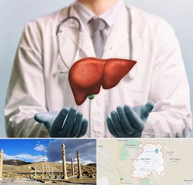 جراح سرطان کبد در مرودشت