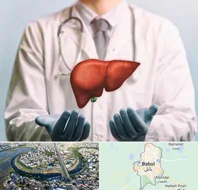 جراح سرطان کبد در بابل