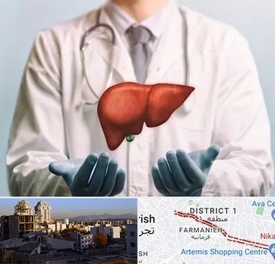 جراح سرطان کبد در فرمانیه 
