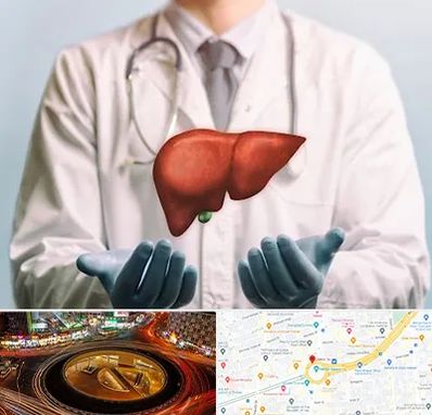 جراح سرطان کبد در میدان ولیعصر 