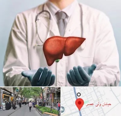 جراح سرطان کبد در ولیعصر شهریار