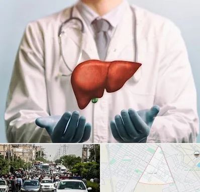 جراح سرطان کبد در سیدی مشهد