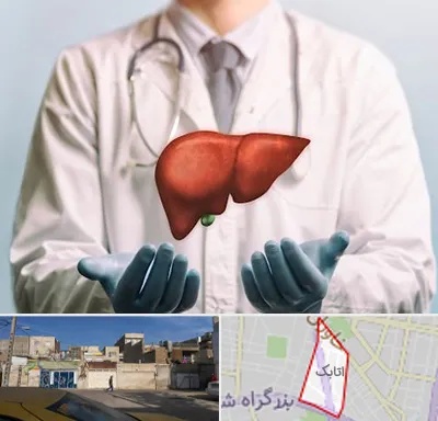 جراح سرطان کبد در اتابک