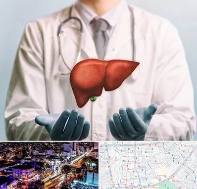 جراح سرطان کبد در منظریه رشت 