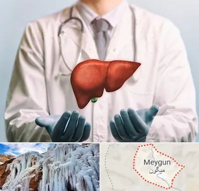 جراح سرطان کبد در میگون