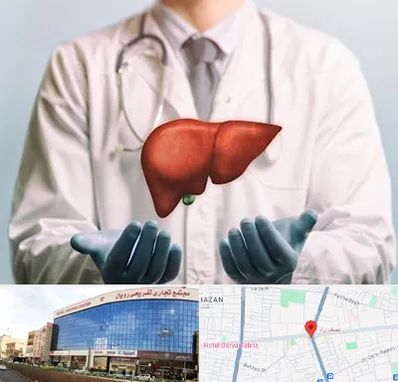 جراح سرطان کبد در نصف راه تبریز