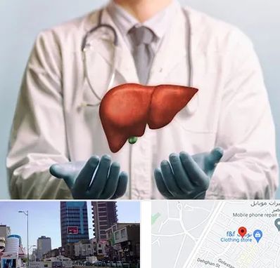 جراح سرطان کبد در چهارراه طالقانی کرج 