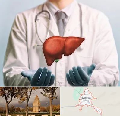 جراح سرطان کبد در تویسرکان