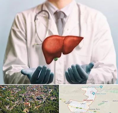 جراح سرطان کبد در دماوند