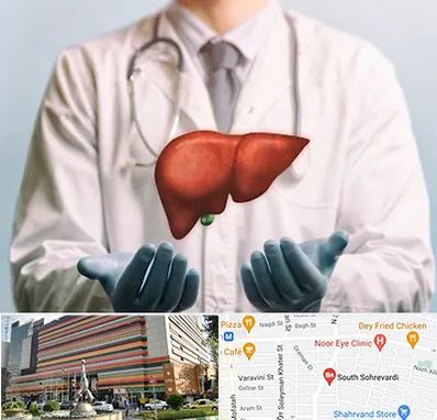 جراح سرطان کبد در سهروردی 