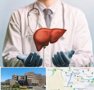 جراح سرطان کبد در صیاد شیرازی مشهد 