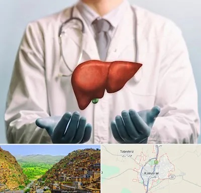 جراح سرطان کبد در کامیاران