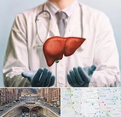 جراح سرطان کبد در منطقه 10 تهران 